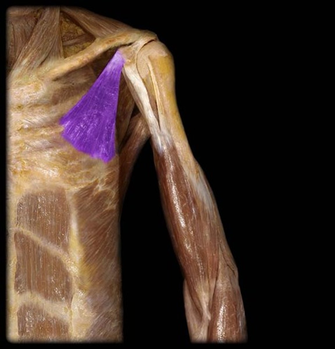 <p>What is the name of this muscle, highlighted in purple and indicated by the arrow?</p>