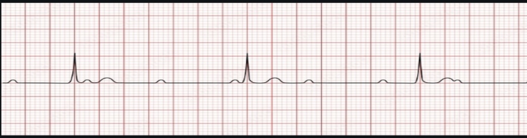 <p>ECG interpretation</p>