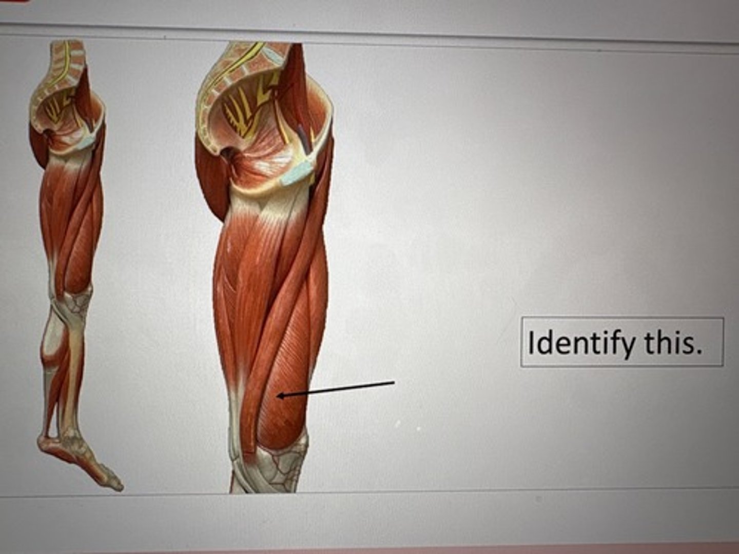 term image