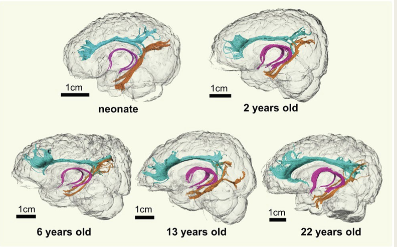 <ul><li><p><span><span>Cingulum = projects from cingulate gyrus to entorhinal cortex</span></span></p></li><li><p><span><span>Mamillothalamic tract = fibers connect MB to cingulate through anterior thalamic nucleus</span></span></p></li><li><p><span><span>Fornix = connects hippocampus to septum, anterior thalamic nuclei, &amp; mammillary body</span></span></p></li></ul><p></p>
