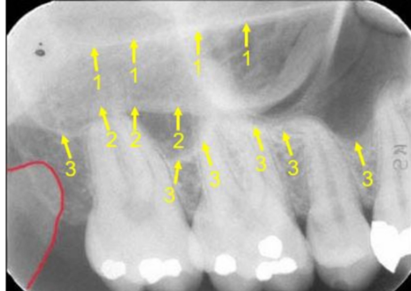 <p>Name the curved, conical structure outlined in the bottom left corner of the image.</p>