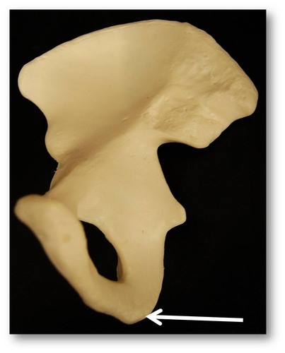 Name this specific region of the pelvic bone.