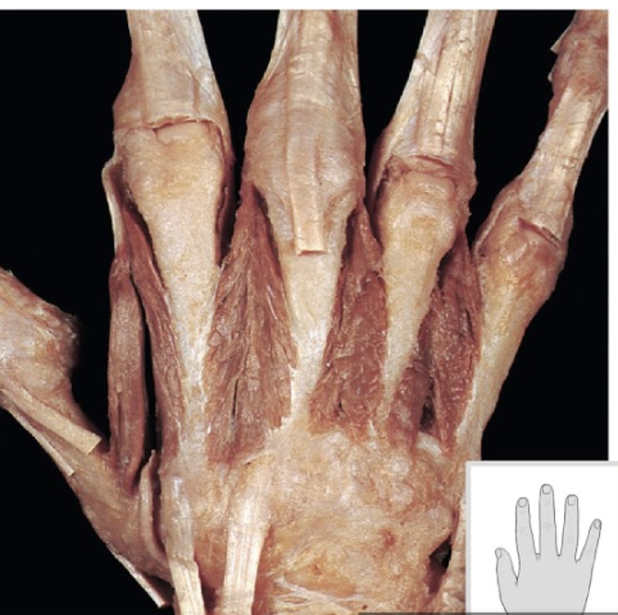 <p>ID muscle</p>