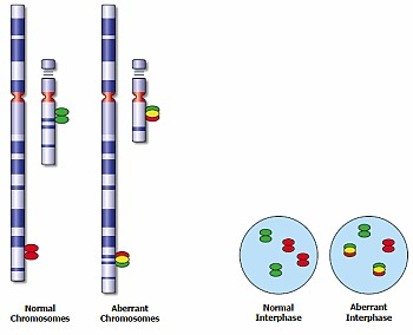 <p>Dual color, dual fusion (2 different colors for the normal genes becomes 2 different colors representing the fusion gene and the derivative gene left behind).<br><br>In normal intact cells, two separate red and two separate green individual signals will be visible, whereas a reciprocal translocation will generate two fused red/green signals (often appearing as single yellow signals), accompanied by one red and one green signal (representing the normal chromosomes).</p>