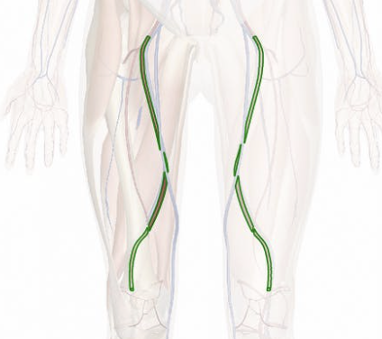 <p>supplies blood to upper leg</p>