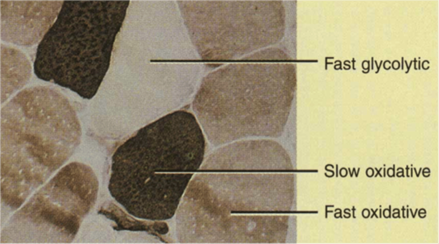 <p>contract quickly, have fast myosin ATPase, and are easily fatigued</p>