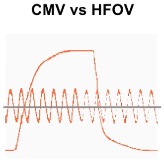 <p>A typpe of mechanical ventilation that uses a constant distending pressure (mean airway pressure [MAP]) with pressure variations oscillating around the MAP at very high rates (up to 900 cycles per minute</p><p>This creates small tidal volumes, with constant PEEP/positive airway pressure</p><p>Decreased ventilator-induced lung injury</p>