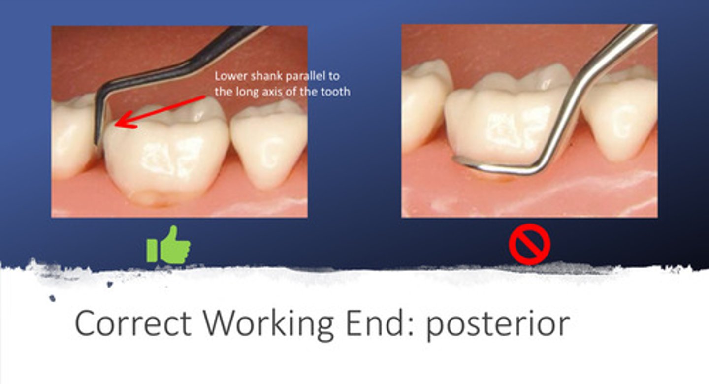 <p>the lower shank should be parallel to the long axis of the tooth!</p>
