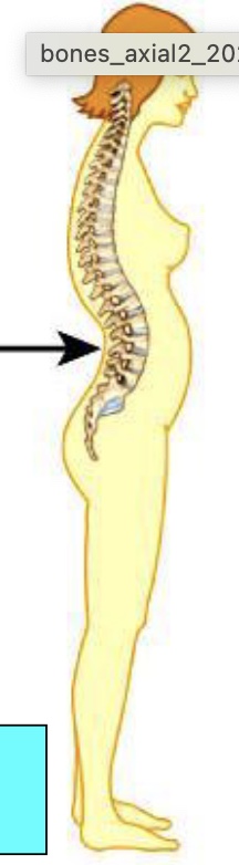 <p>What type of abnormal curve is this?</p>