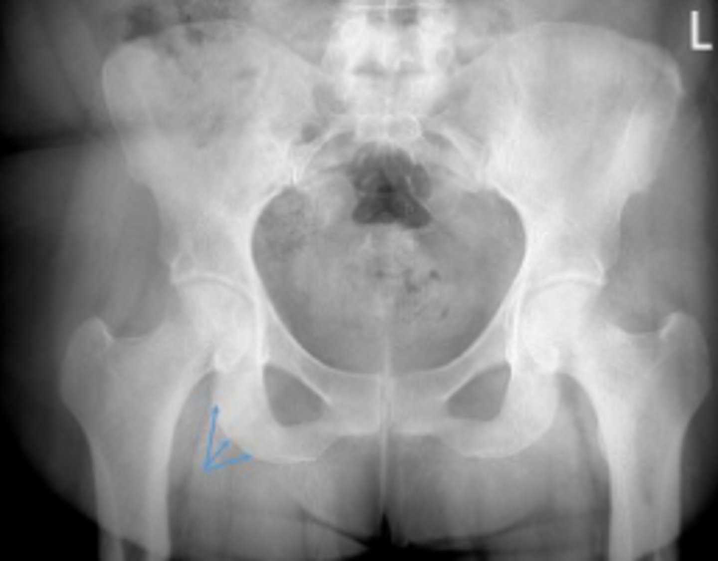 <p>What are the arrows pointing to?</p>