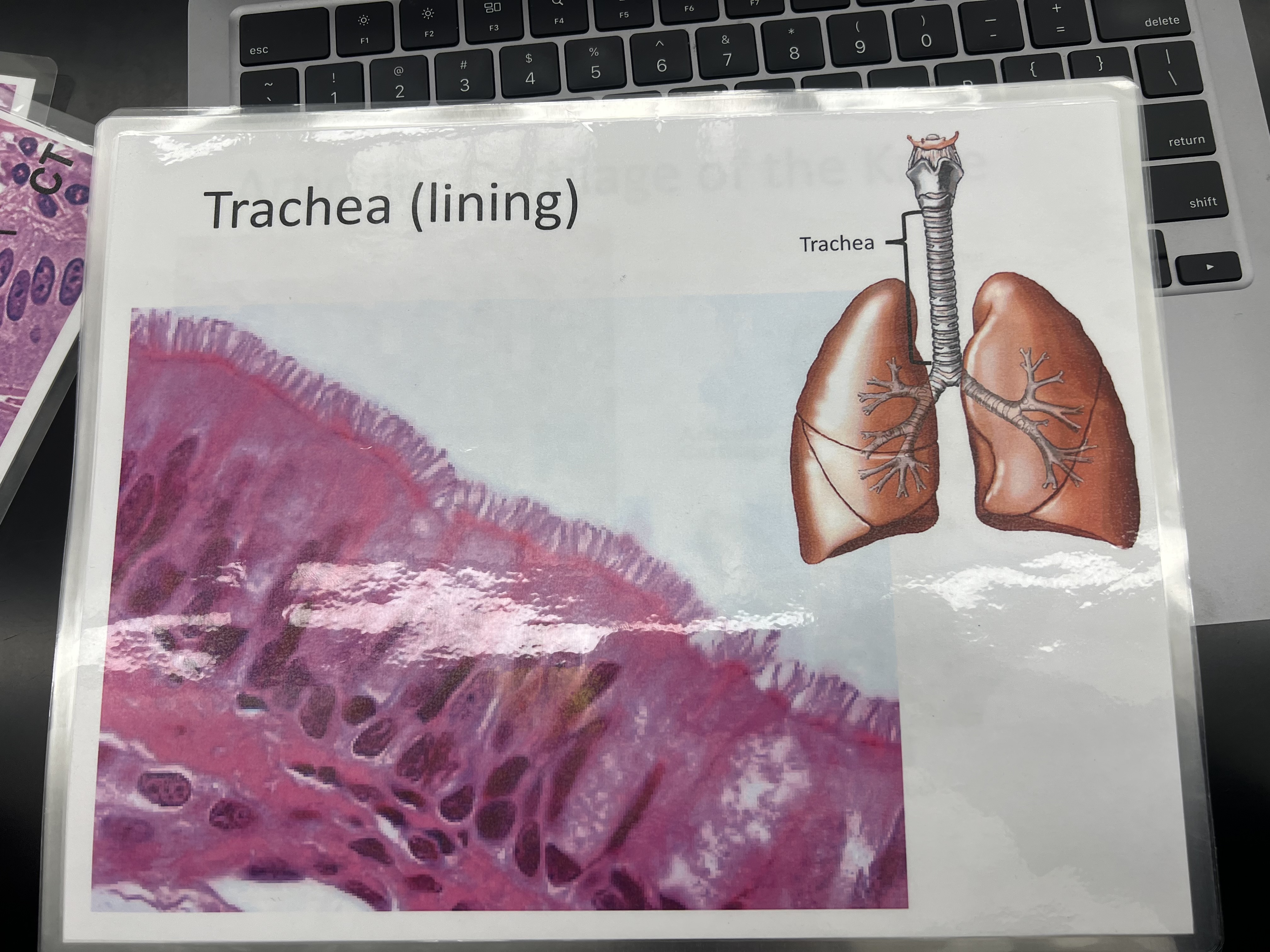 <p>Function: Protection, secretion, and movement of mucus</p><p>Location: Linings of the respiratory passages</p><p>structure: a single layer of tall, columnar cells with nuclei at various levels, creating the illusion of multiple layers</p>