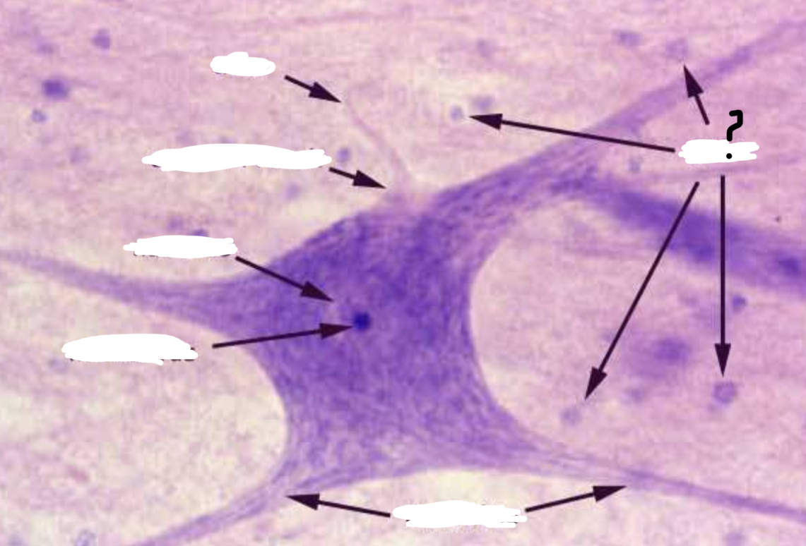 <p>What is the arrow pointing to?</p>