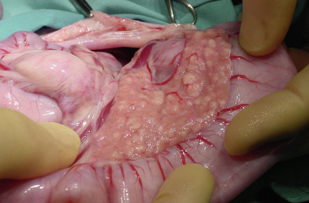 <p>Pancreas from an 8-year-old, spayed female, mixed breed cat. The cat has diabetes mellitus which you have been managing well for the past year. She presented with a history of hyporexia progressing to anorexia, lethargy, vomiting, and diarrhea. What conditions might this cat have?</p>
