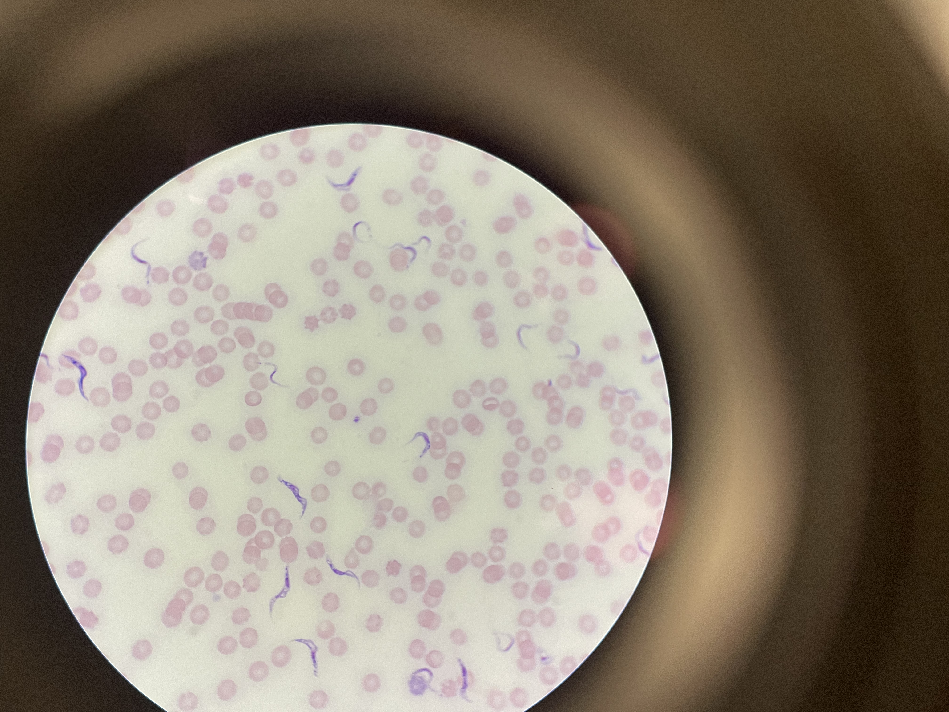 <p>Trypanosoma Brucei</p>