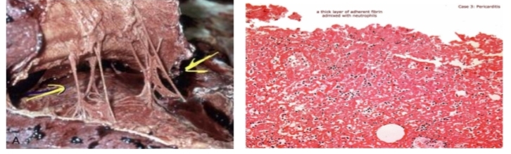 <p>identify?and What is the key feature of this?</p>