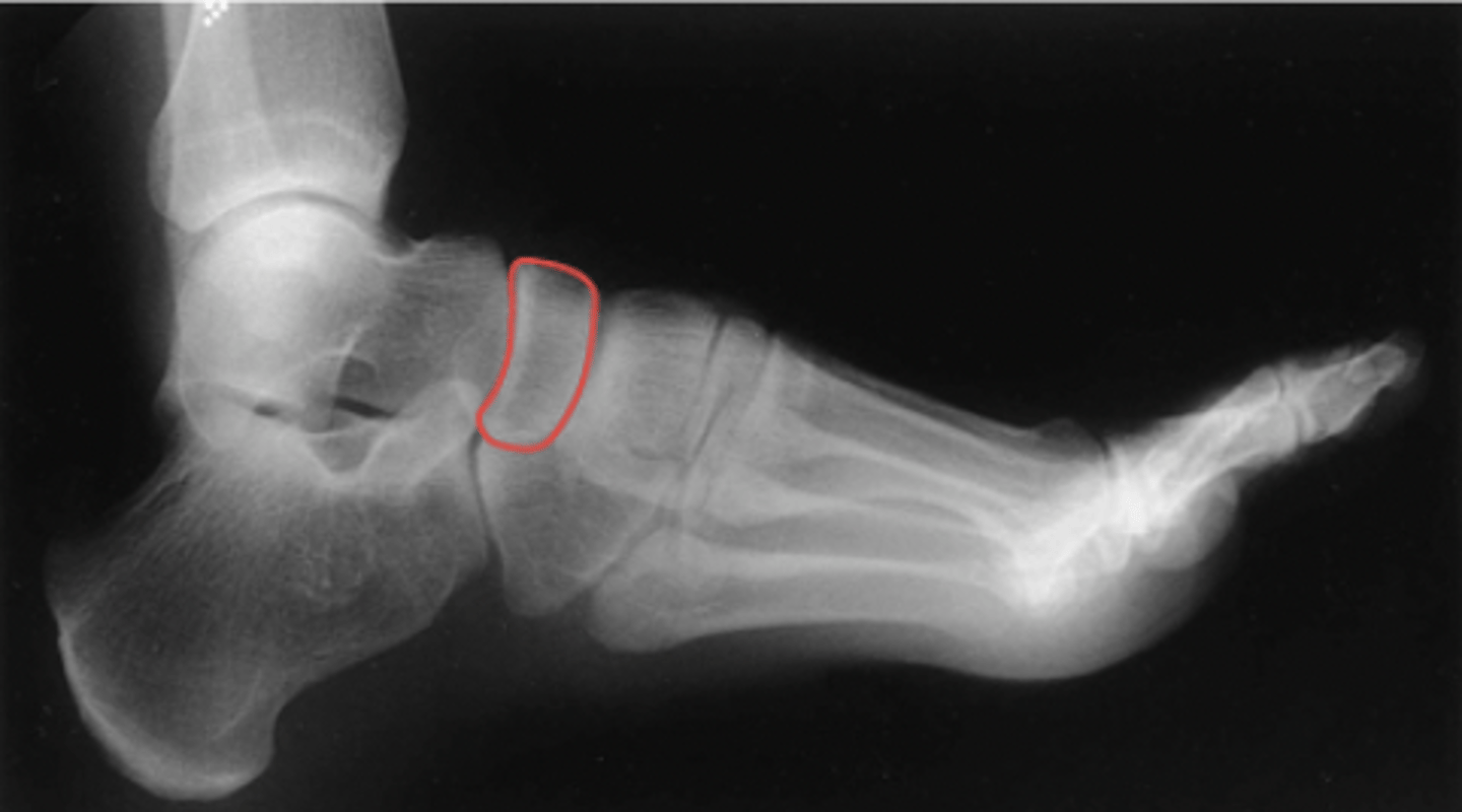 <p>What structure is highlighted?</p>