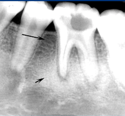 <p>most likely diagnosis? </p>