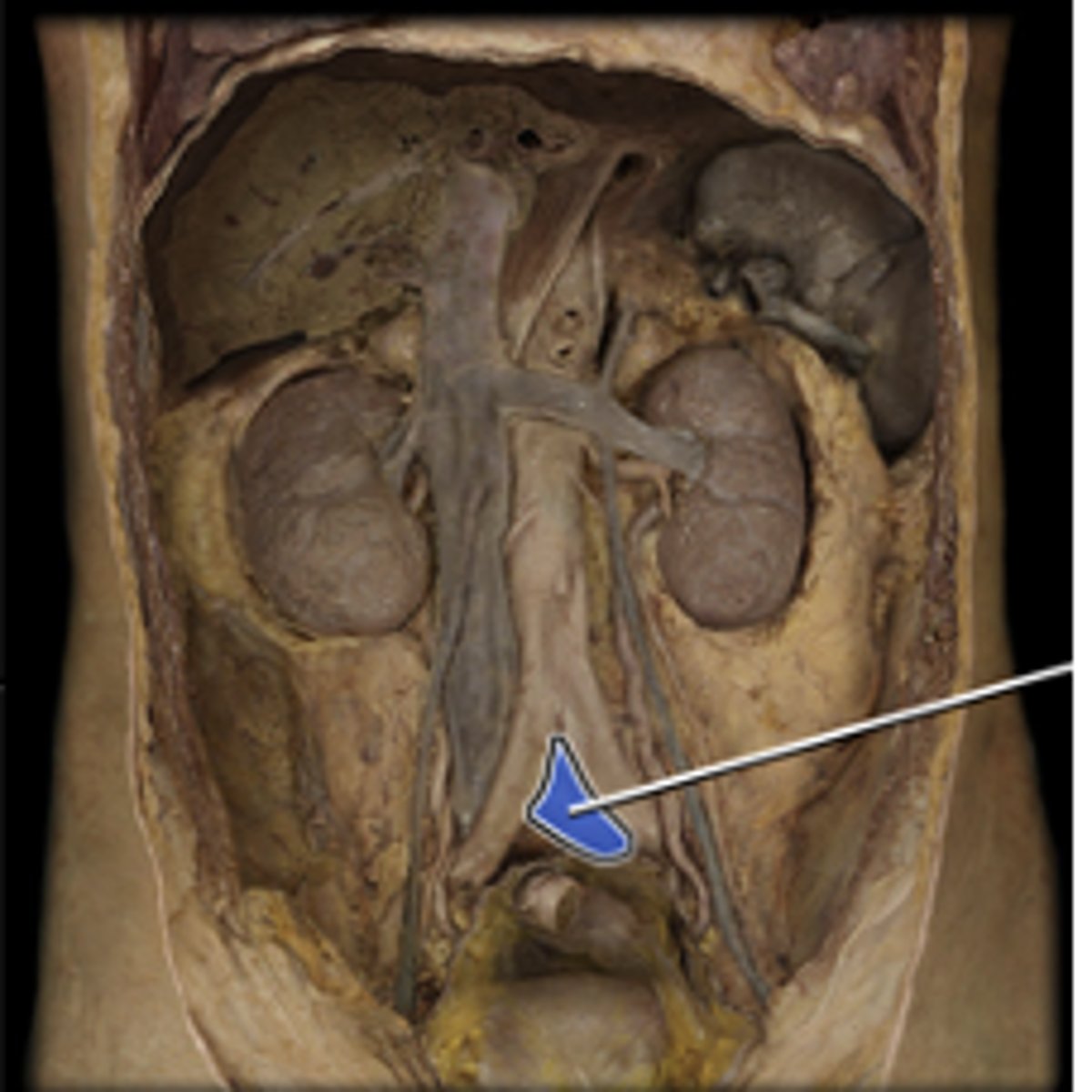 <p>drains blood from pelvic walls, pelvic viscera and lower limb</p>