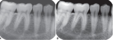 <p>which picture is high contrast</p>