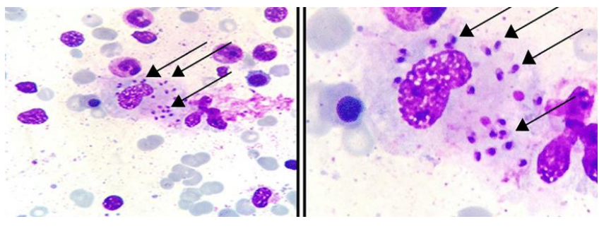 <p>State the morphological features of amastigote.</p>