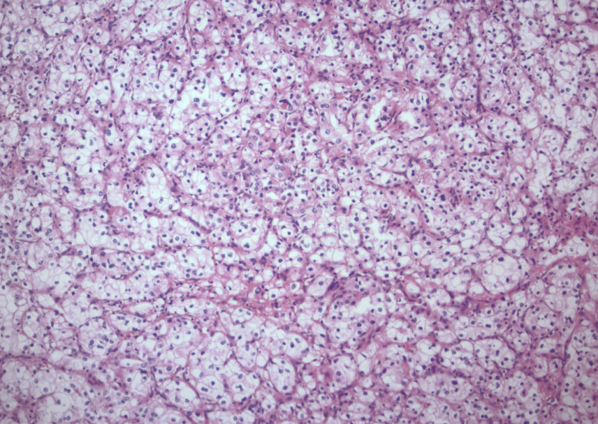 <p>glycogen and lipid cytoplasm with rich vascular network</p>