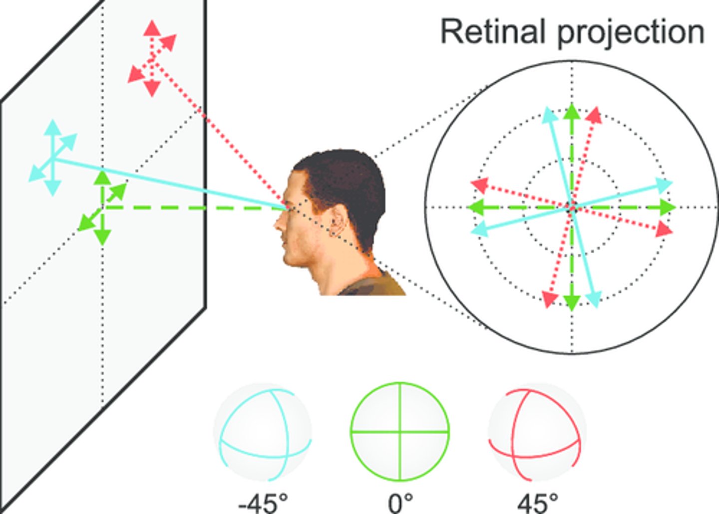 <p>the vertical meridian of the eye is tilted relative to objective vertical → occurs in absence of rotation around line of sight</p>