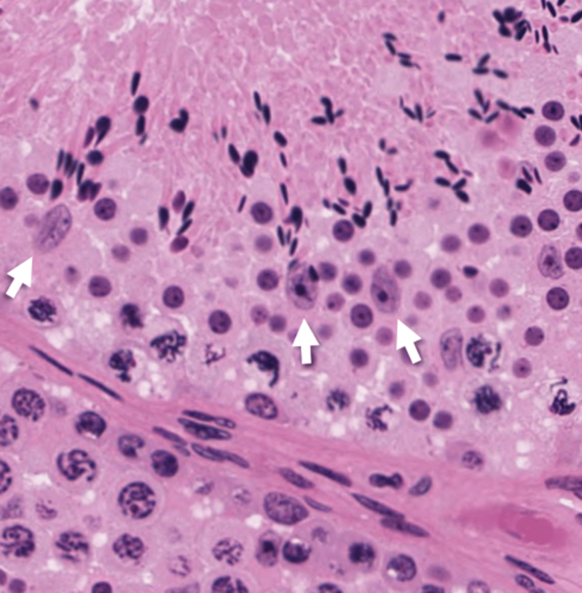 <p>What cells are the arrows pointing to?</p>