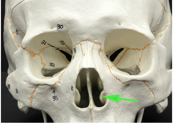 <p>What is the bone marked by the green arrow?</p>