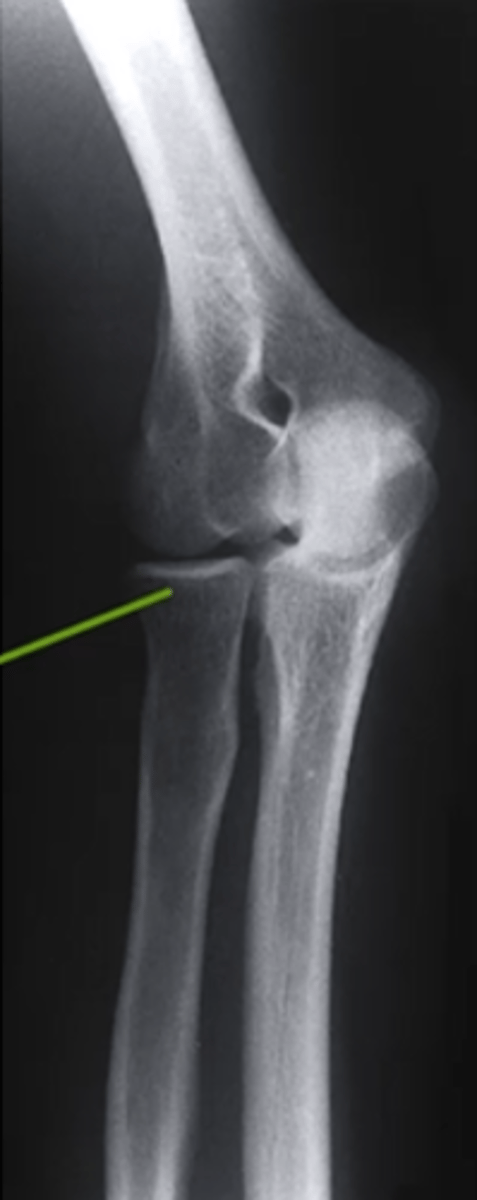 <p>what view is this</p>