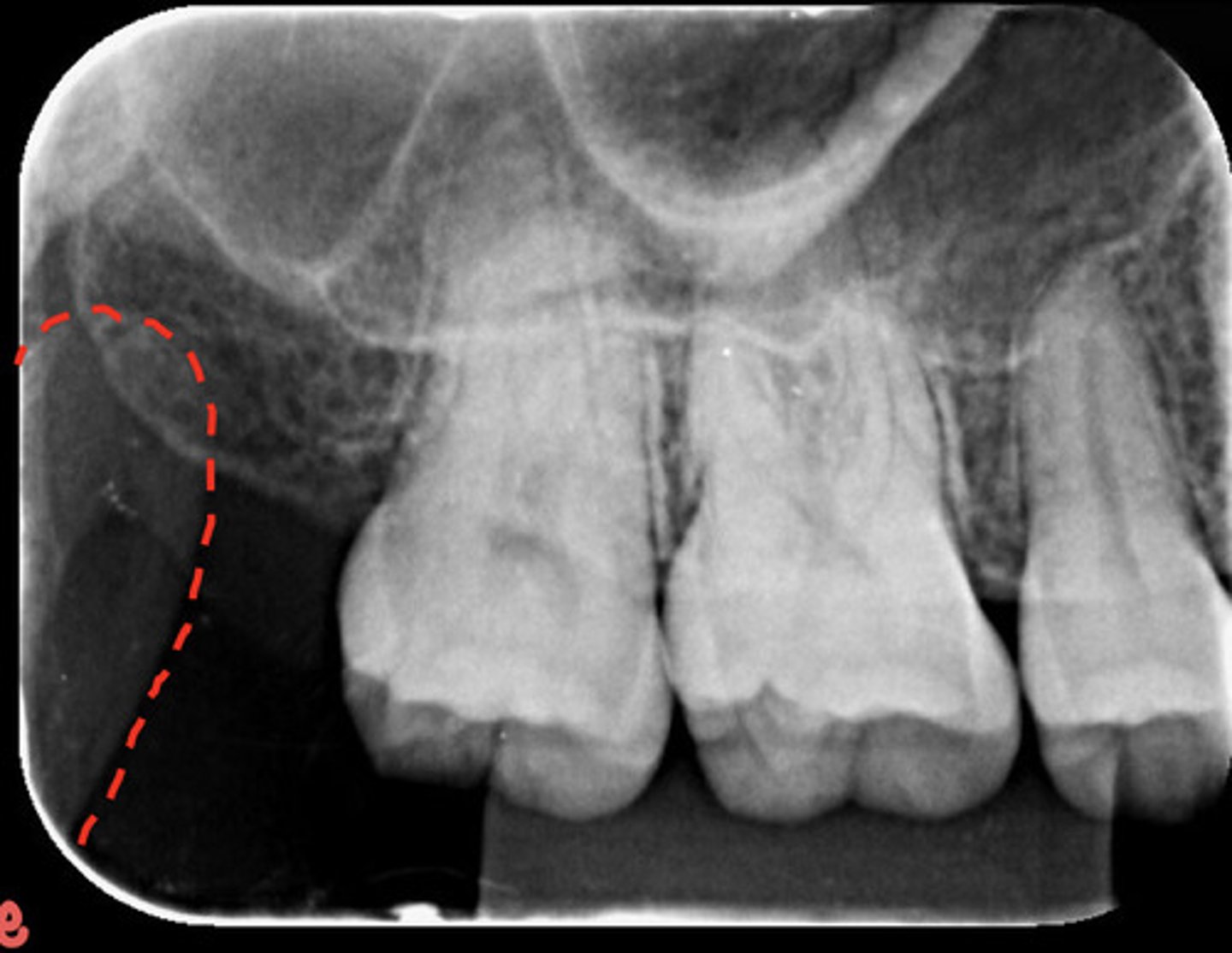 <p>What is the red dotted line representing?</p>