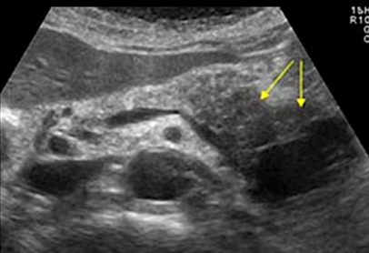 <p>Describe this mass</p><p>Dx?</p>