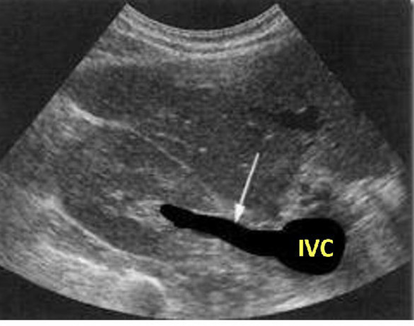 <p>What is this picture showing?</p>