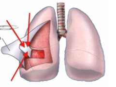 <p>Membrane that covers the surface of each lung.</p>