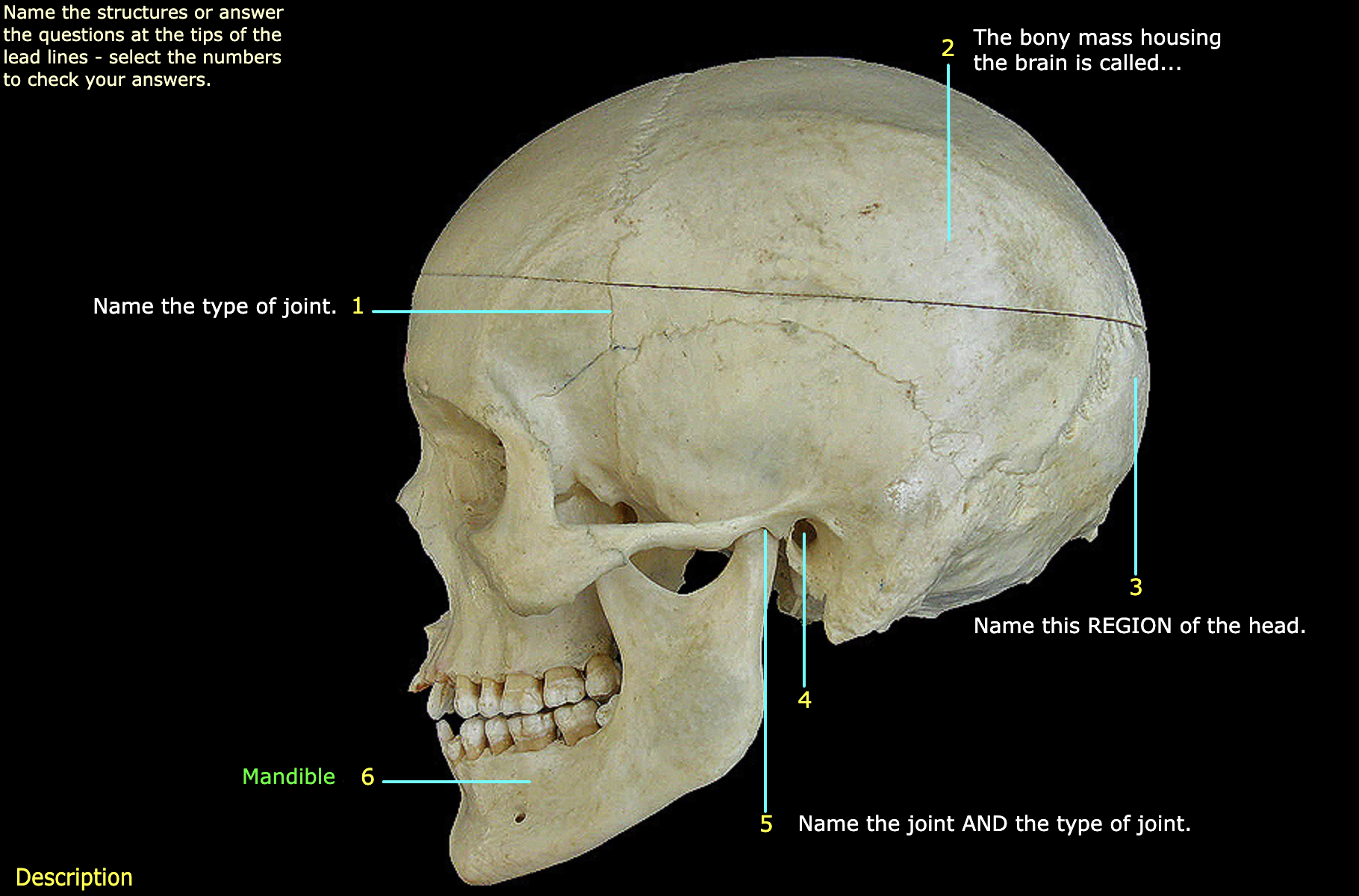 What structure is labeled 2? 
