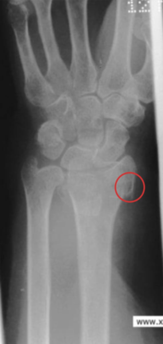 <p>What is the issue?</p>