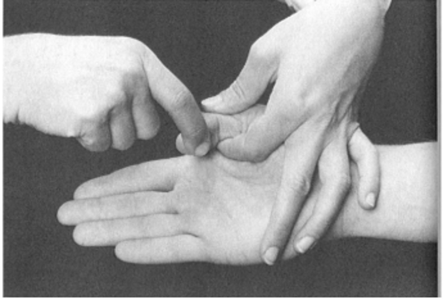 <p>KH: könyök enyhe flexio, alkar supinatio, hüvelykujj pici abdukcióban</p><p>Rögzítés: proximalis phalanxig</p><p>Hajlítsa be az IP-t!</p><p>Ellenállás: distalis phalanxra flexioval szemben ujjbeggyel</p>