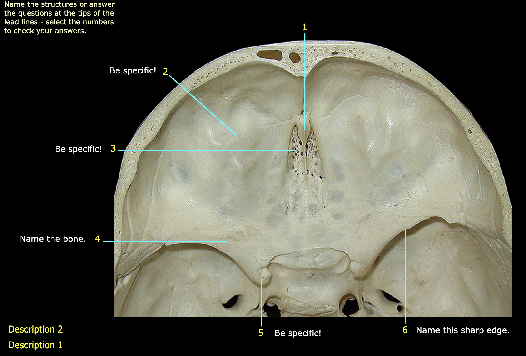 What structure is labeled 1?