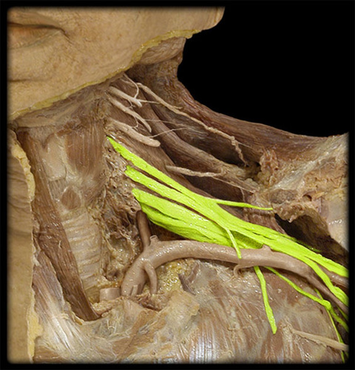 <p>What is this nerve?</p>