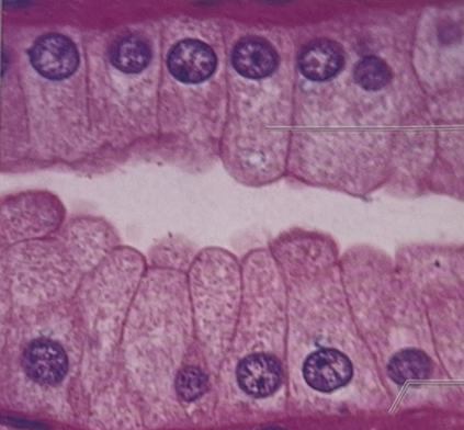 <p>simple columnar</p>