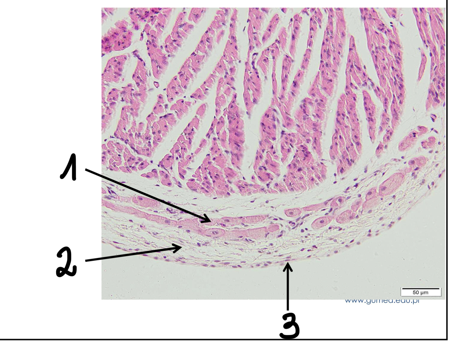 term image