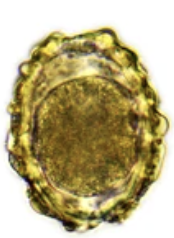 <p>Name what parasite this egg belongs to?</p>