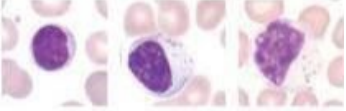 <p>What lymphocytes?</p>