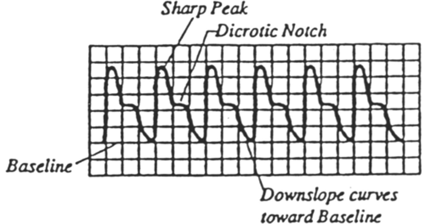 <p>Biphasic - always above baseline</p><p>Rapid upstroke in systole</p><p>Sharp & defined peak</p><p>Delayed downstroke</p><p>Flat dicrotic notch - on downstroke</p>