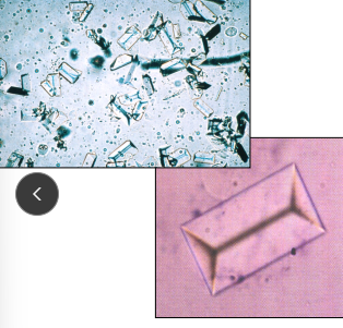 <ul><li><p>Due to infection</p></li><li><p><span style="background-color: transparent;"><strong>Et:</strong></span><span style="background-color: transparent; color: red;"><strong> <u>+ Urease bacti UTI (D), Alkaline urine</u></strong></span></p><ul><li><p><span style="background-color: transparent; color: blue;"><strong>staph, proteus, pseudomonas, klebsiella infection</strong></span></p></li></ul></li><li><p><span style="background-color: transparent;"><strong>Sig: <u>Dogs → bladder</u></strong></span></p></li><li><p><span style="background-color: transparent;"><strong>Cs:</strong> location, duration, UTI dependent</span></p></li><li><p><span style="background-color: transparent;"><strong>Dt: <u>radiopaque, culture</u></strong>, UA</span></p></li><li><p><span style="background-color: transparent;"><strong>Tx: <u>Dissolution diet + antibiotics</u></strong>, catheter, urohydropropulsion, Sx</span></p><ul><li><p><span style="background-color: transparent;"><u>eradicate UTI</u>, recurrence >20%</span></p></li><li><p><span style="background-color: transparent;">Urine pH <6.8</span></p></li></ul></li></ul><p></p>