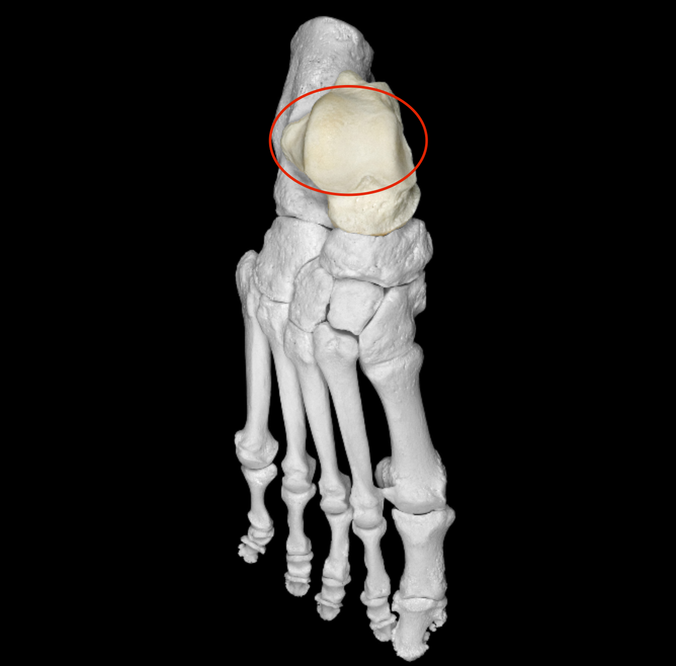 <p>superior smooth region of trochlea </p>