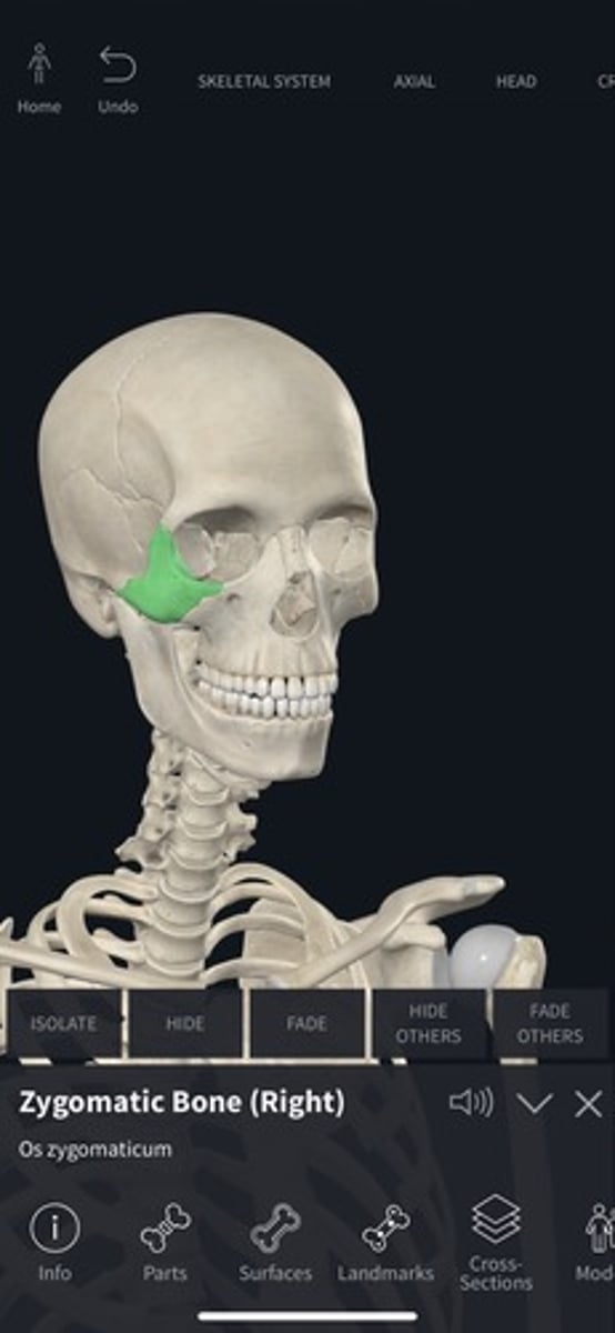 <p>Cheekbones; form the lateral aspect of the face.</p>