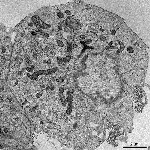 Transmission electron microscopy