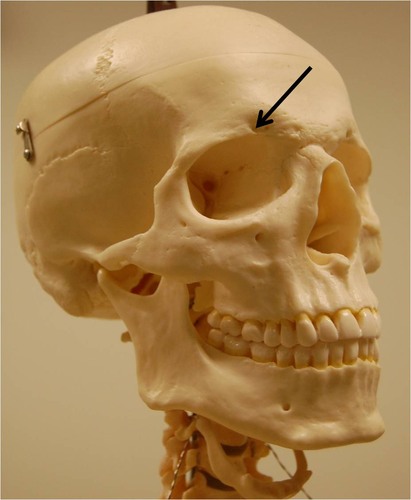 <p>hole above eye socket</p>