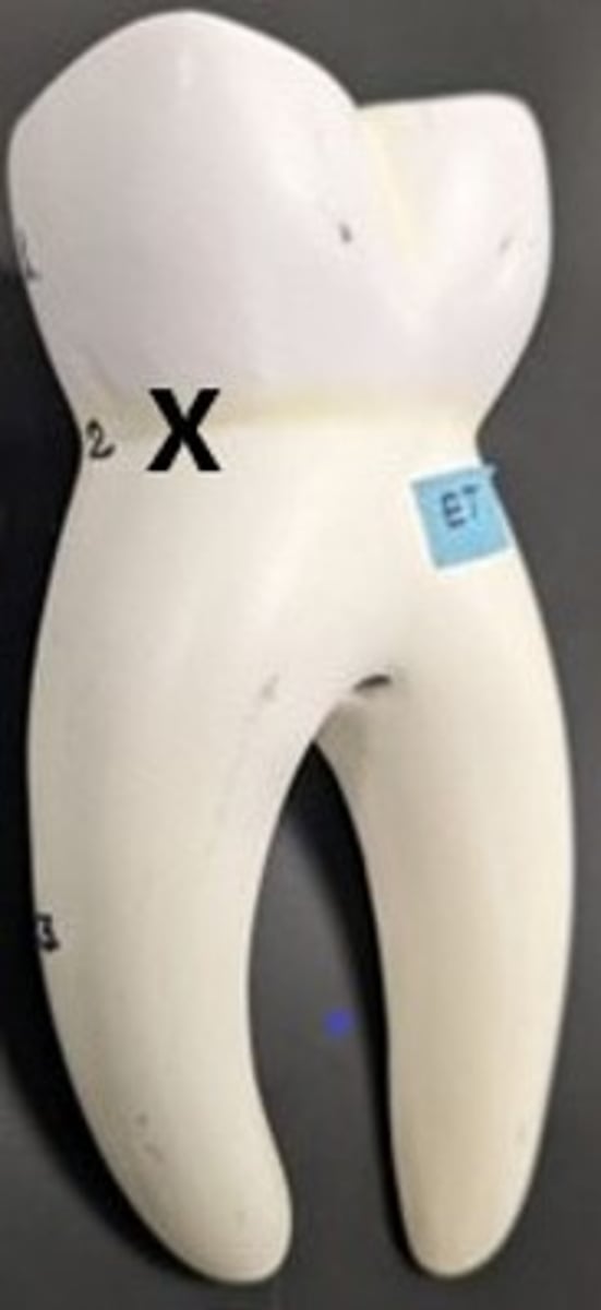 <p>ID the External Tooth Region</p>