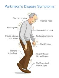 <p>Parkinsons</p>